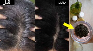 استعيدي شبابك تاني لو عندك قرنفل انسي الشيب المبكر بملعقة واحدة هيختفي بدون عودة نهائي