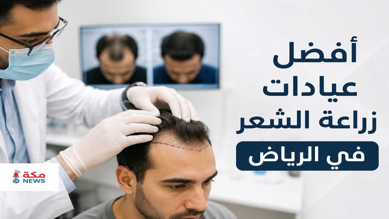 أفضل عيادات زراعة الشعر في الرياض.. مقارنة الأسعار وأحدث التقنيات