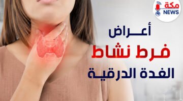 أعراض فرط نشاط الغدة الدرقية وعلاجه.. الأسباب وطرق التشخيص وأهم النصائح